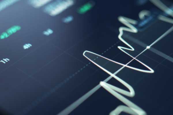 盈新发展落子“芯”赛道，拟斥资收购行业“小巨人”长兴半导体超81%股权